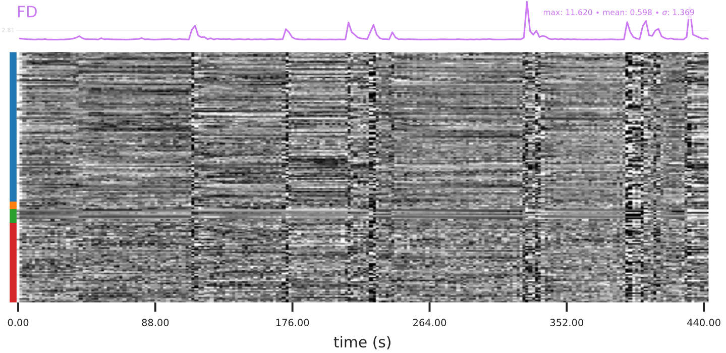 Example of head motion showing up as vertical patterns in the carpet plot.