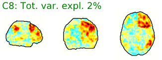 Example ICA-AROMA component, including spatial map (left), time-series (right, top) and frequency power spectrum (right, bottom). 