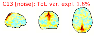 Example spatial maps of artifact/noise components.