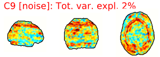 Example spatial maps of artifact/noise components.