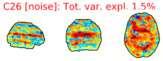 Example spatial maps of artifact/noise components.