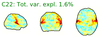 Example spatial maps of activation-related components.